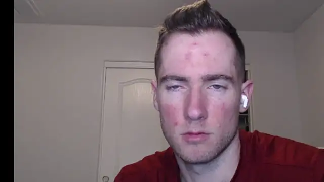 rawdawgrex online show from 7, 3, 2026